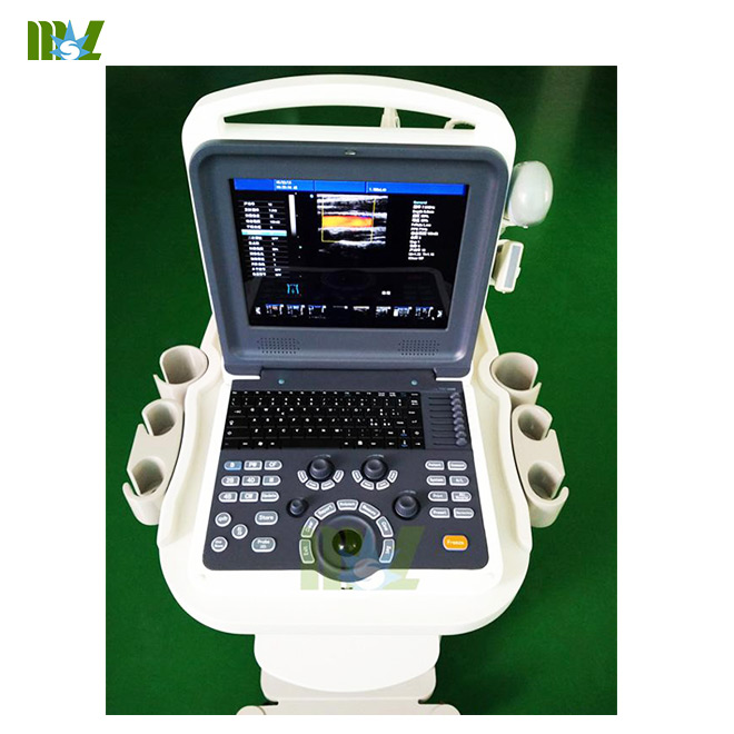 Portable 4d Color Doppler Ultrasound Diagnostic Imaging System Mslcu28