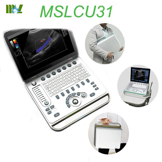 color doppler ultrasound MSLCU31