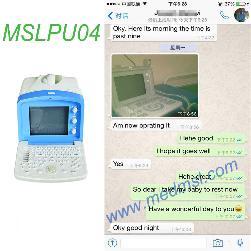 Portable ultrasound for sale MSLPU04 Praises From Clients