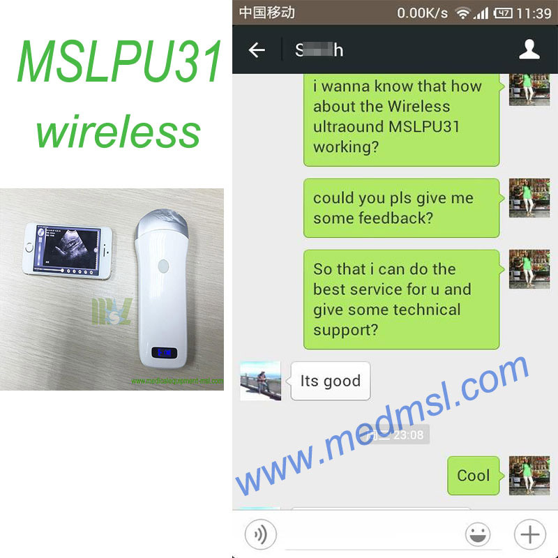 The India customer feedback of MSLPU31