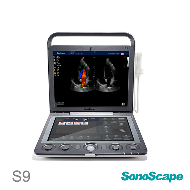 SonoScape S9