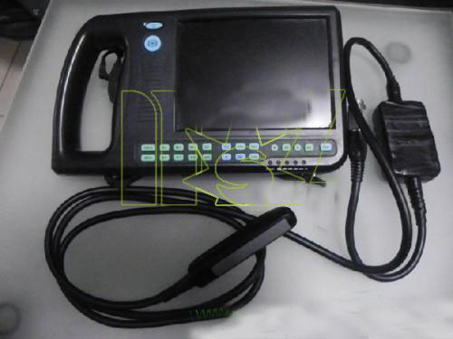 palmsmart ultrasound scanner
