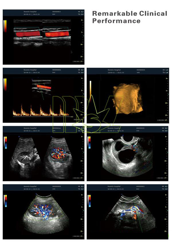 ultrasonic imaging system