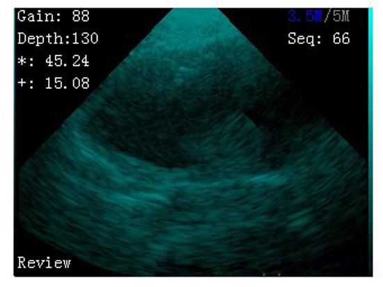 wrist ultrasound image