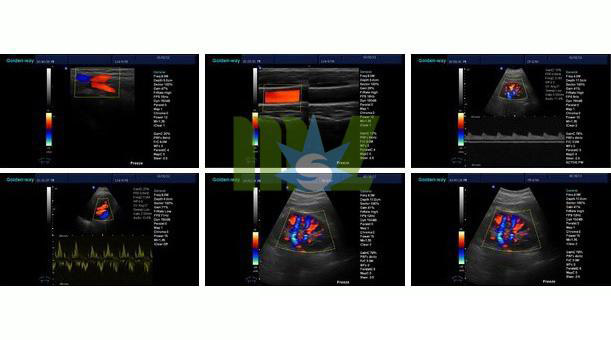 color ultrasound images