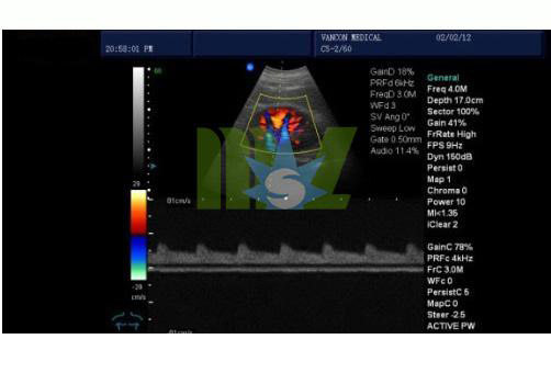 ultrasound image for kidney