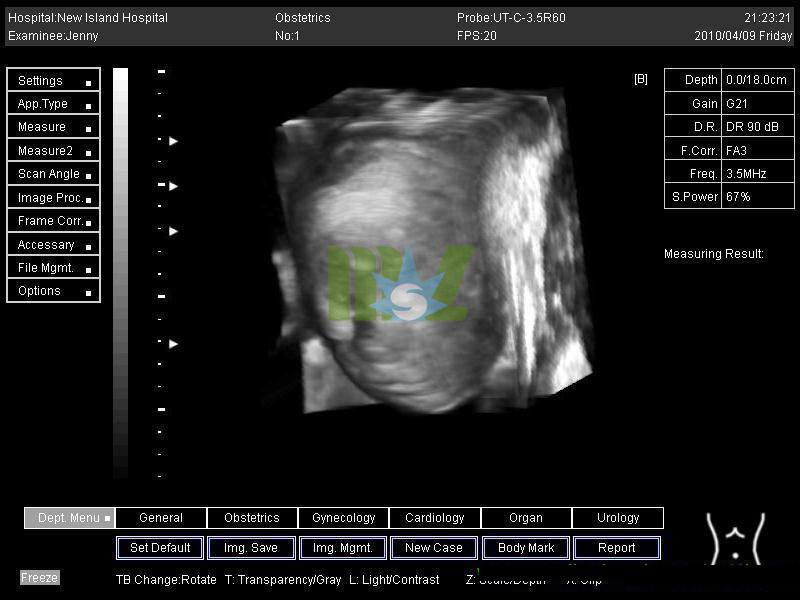 4d ultrasound image
