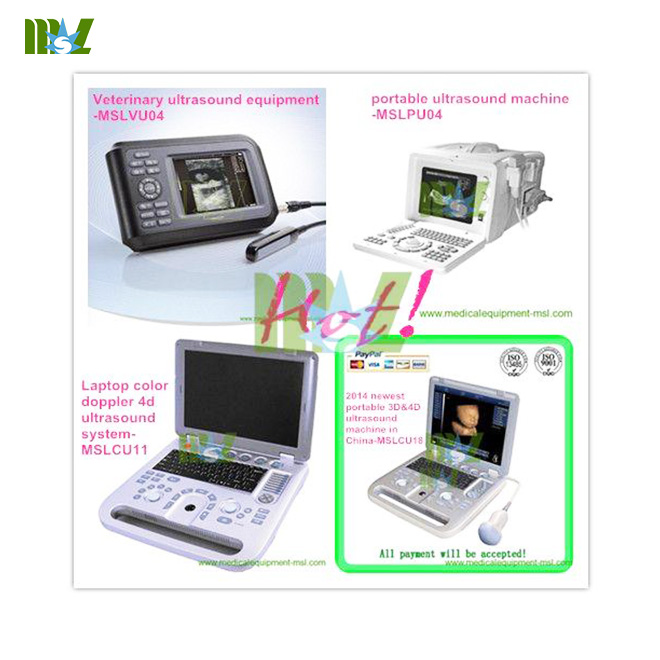 2014 newest portable 3D&4D ultrasound machine
