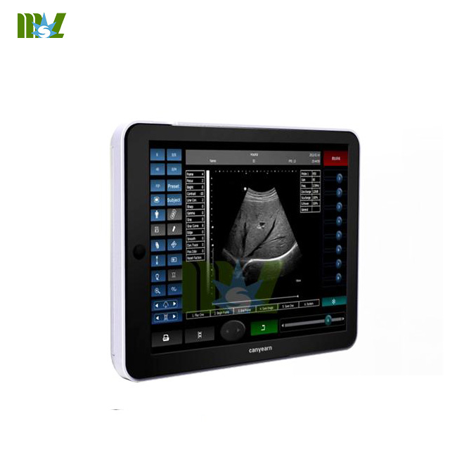 Cost Effective Clinic Ipad Ultrasound Scanner Mslpu09