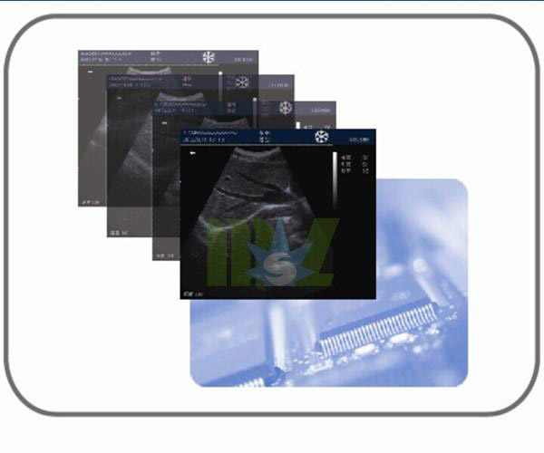 veterinary rotatable LED desktop ultrasound scanner MSLVU18-5