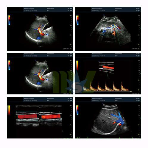 3D Color cardiac ultrasound machine MSLCU16 for sale