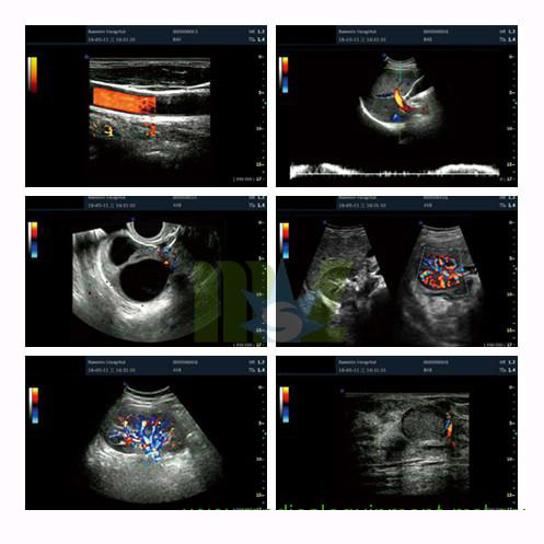 3D Color cardiac ultrasound machine MSLCU16