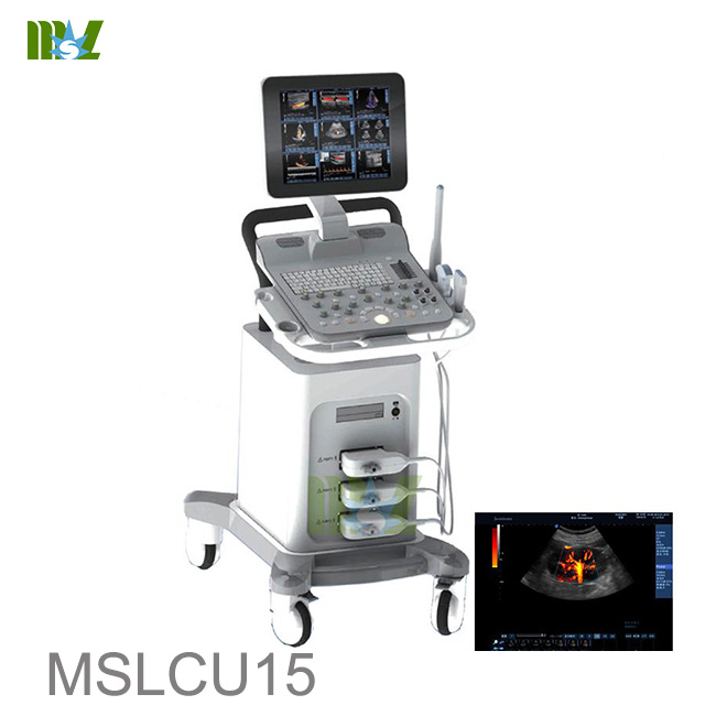  Trolley 3D/4D scans Pregnancy ultrasound-MSLCU15