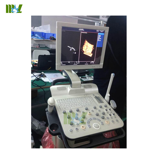 Trolley Pregnancy ultrasound MSLCU15