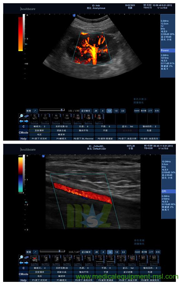 3D/4D scans Pregnancy ultrasound MSLCU15
