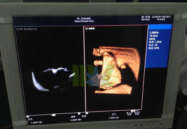 scans Pregnancy ultrasound MSLCU15