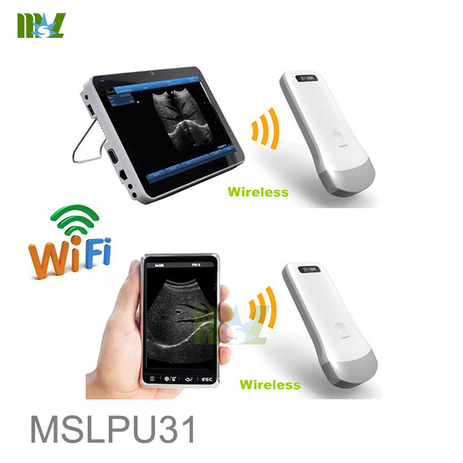 Advanced wireless ultrasound transducer MSLPU31