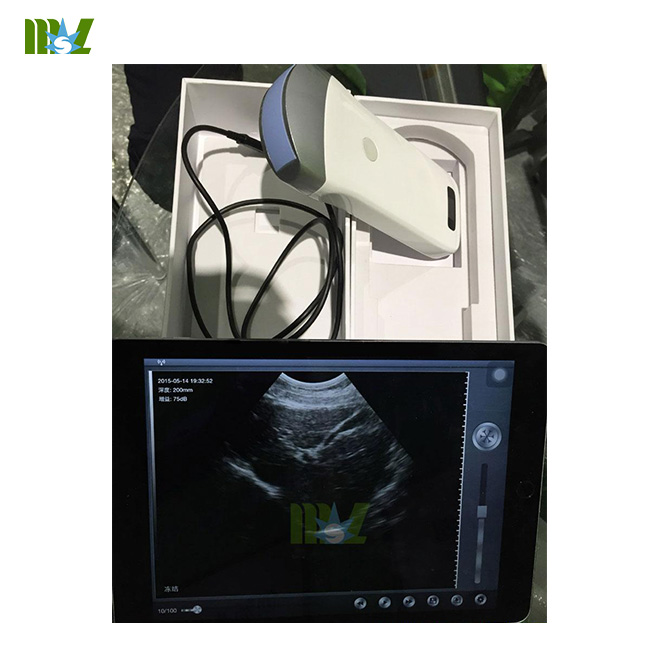 wireless ultrasound probe MSLPU31 working with iphone