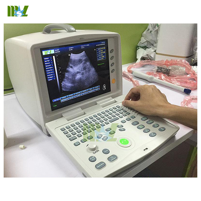 MSL PC based ultrasound device