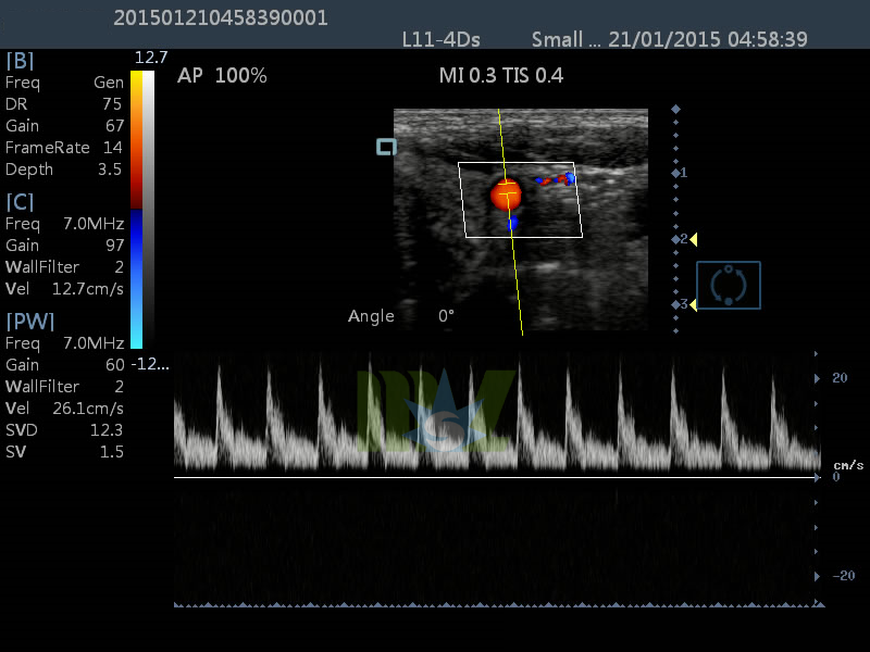 color doppler ultrasound MSLCU25 for sale