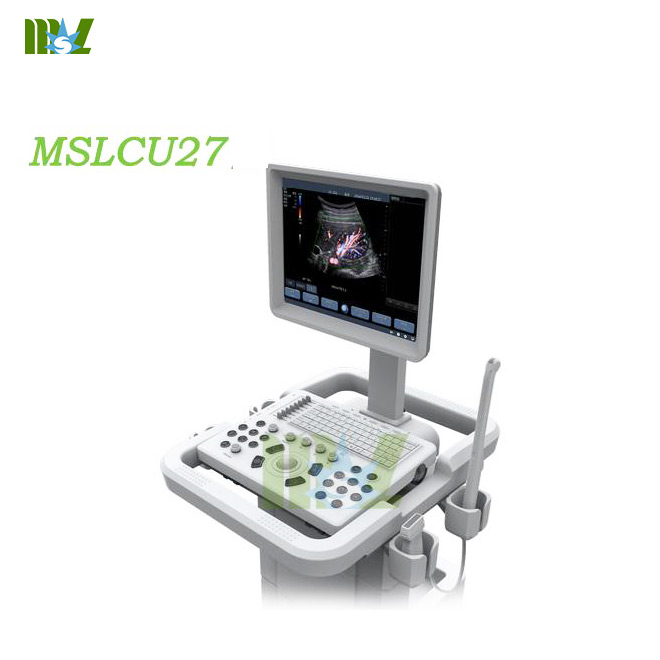 Trolley ultrasonic diagnostic imaging system-MSLCU27