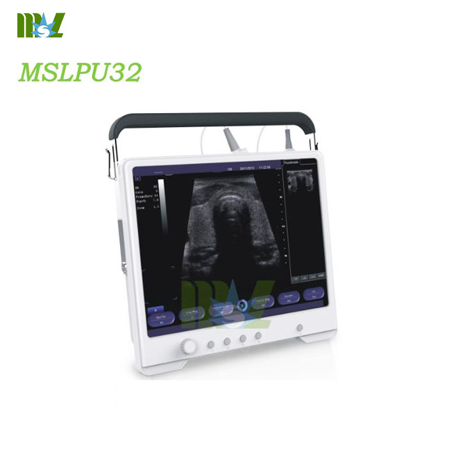 Protable touch screen ultrasound machine MSLPU32