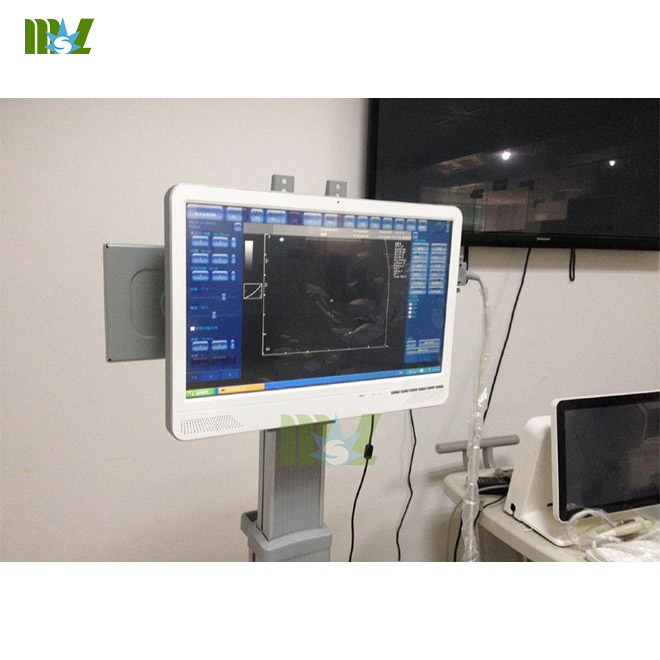 MSLtouch screen laptop ultrasound machine MSLCU29