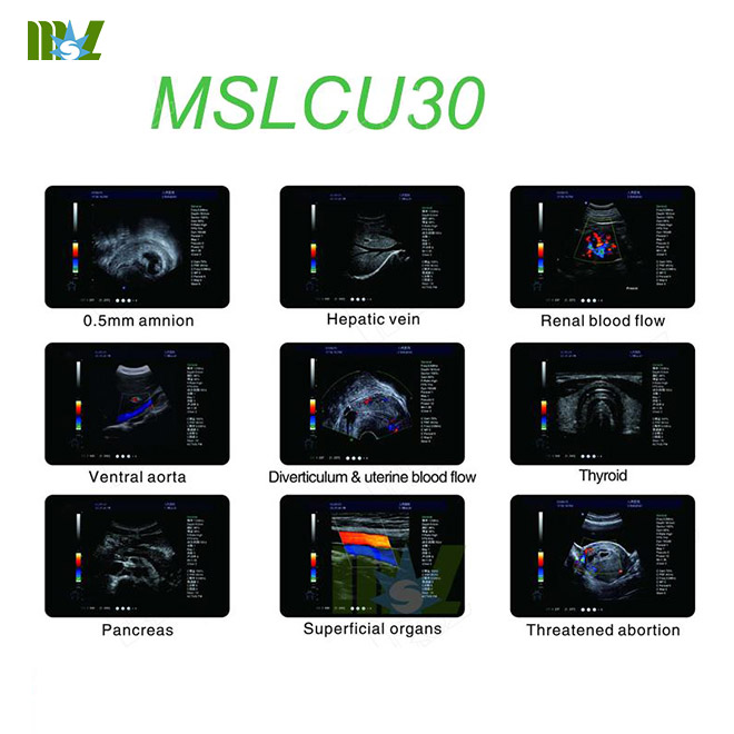 4D color doppler MSLCU30