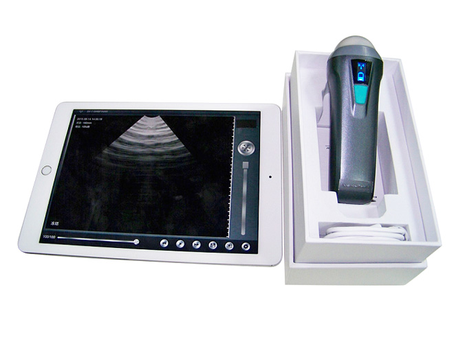 MSL portable wireless ultrasound probe MSLPU36