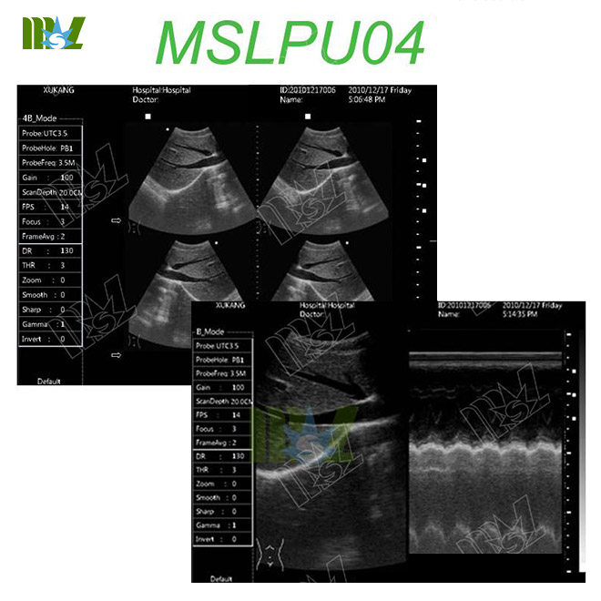 MSL portable ultrasound machine MSLPU04 for sale