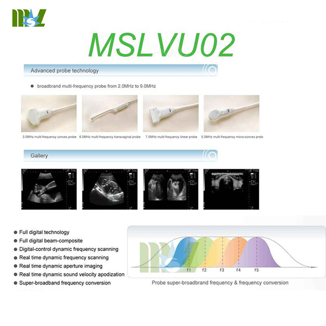 Animal ultrasound machine used in cattle, etc.-MSLVU02