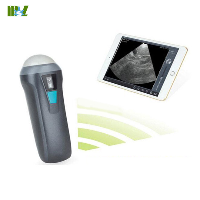 best wireless ultrasound probe MSLPU36