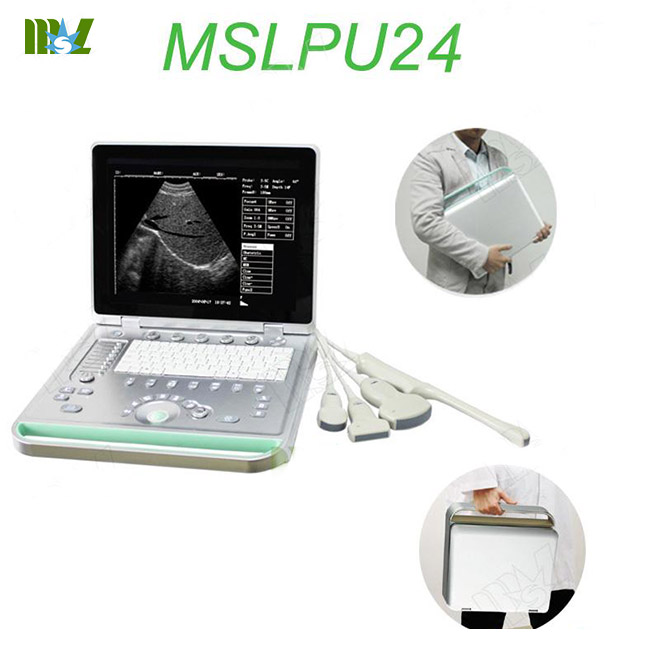 New LED screen laptop ultrasound machine MSLPU24