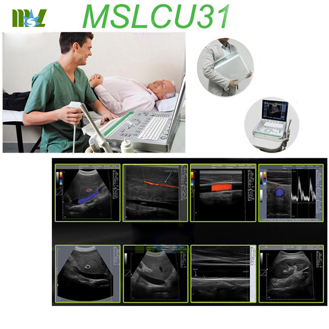 portable color doppler ultrasound MSLCU31