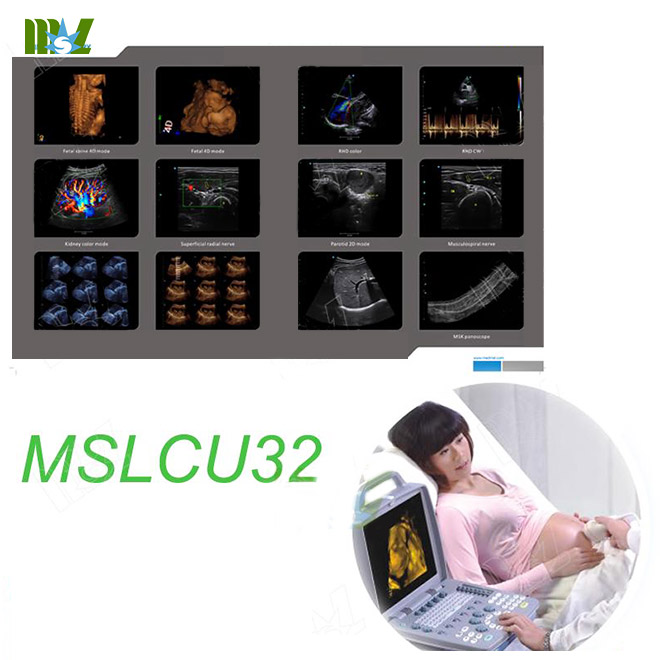 Color Doppler ultrasound MSLCU32 for sale
