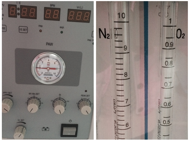 cheap Anesthesia Ventilator for sale-MSLGA14