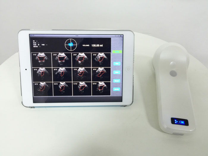 4D Wireless Probe Bladder Ultrasound Scanner MSLPU37
