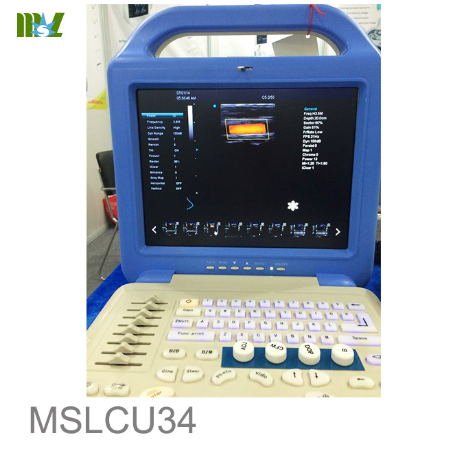 new Ultrasound Scanner MSLCU34