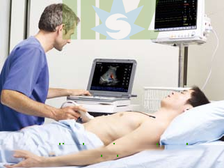 Use Hand-carried color doppler system Mindray M5