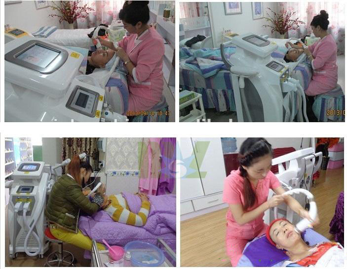 Advanced New generation & Stable quality MSLOL01 4 in 1 OPT Elight ipl hair removal machine