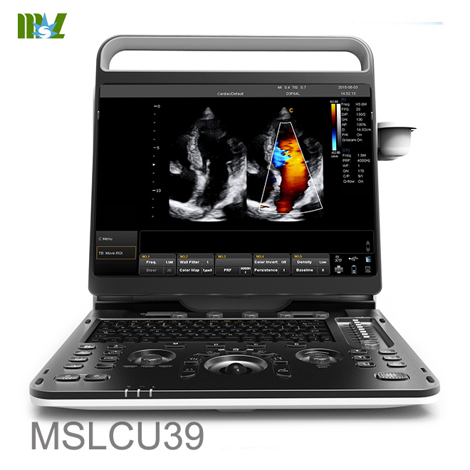 Professional Ultrasound equipment MSLCU39