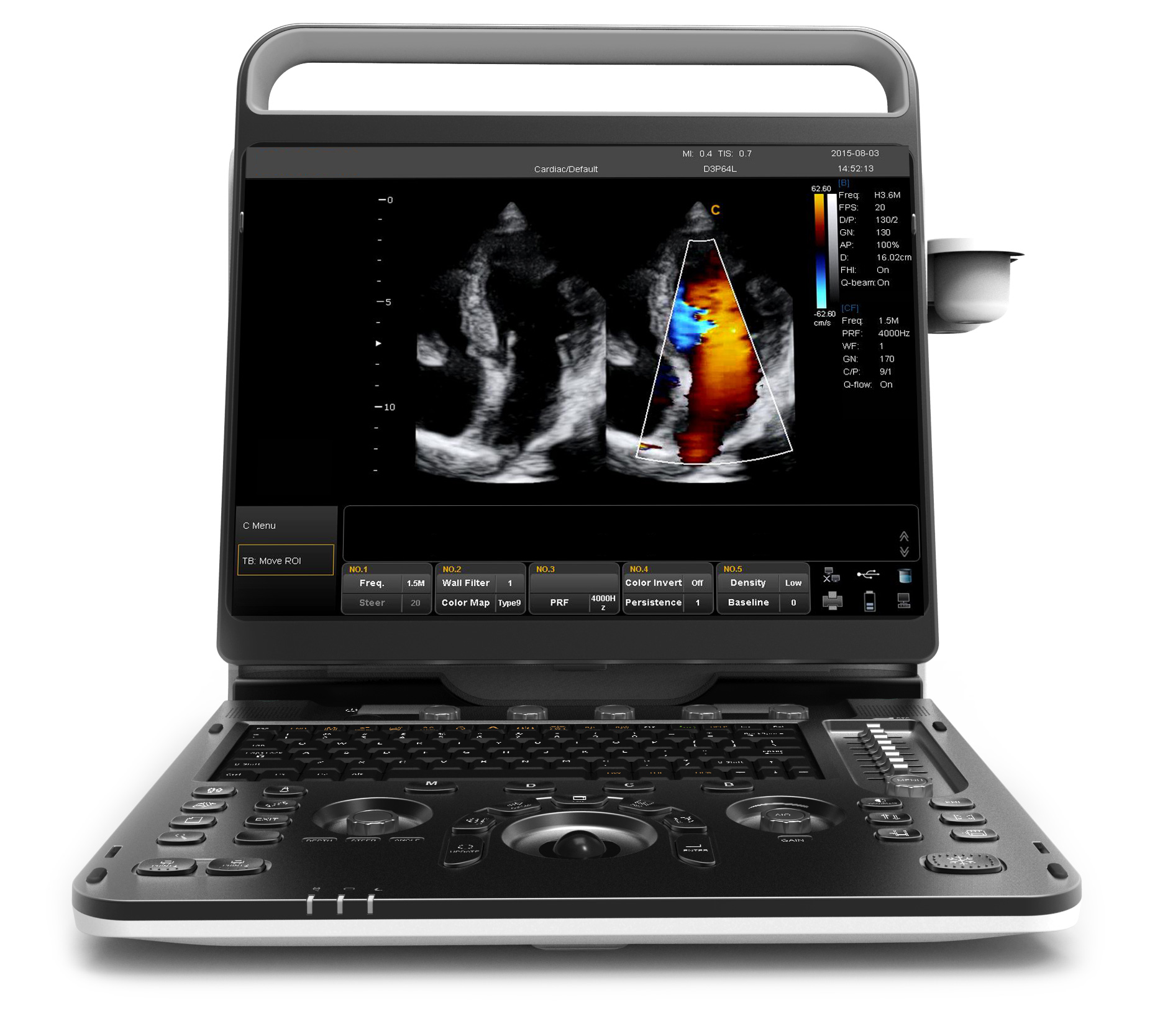 Cheap Ultrasound equipment MSLCU39