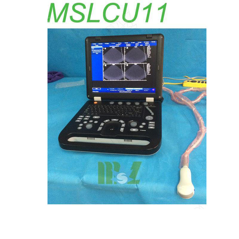 Protable touch screen color doppler ultrasound MSLCU25