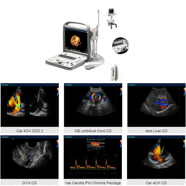 color doppler ultrasound prostate cancer