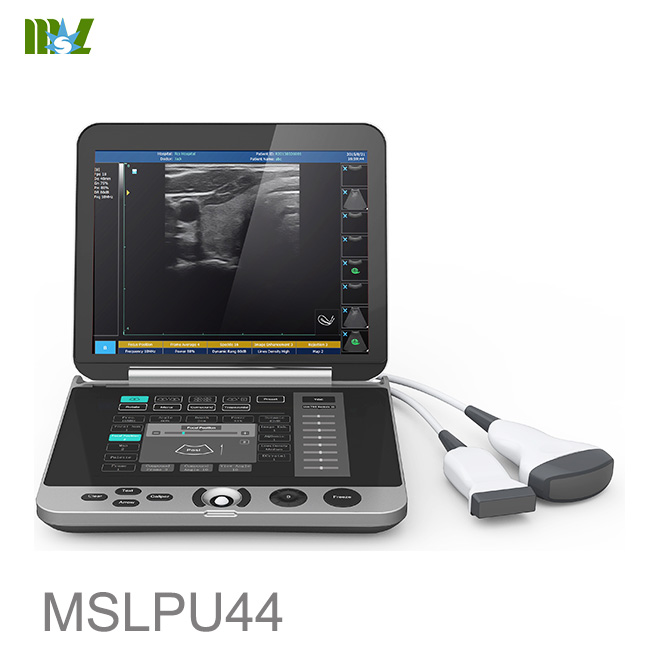 laptop ultrasound machine with touch screen keyboard MSLPU44