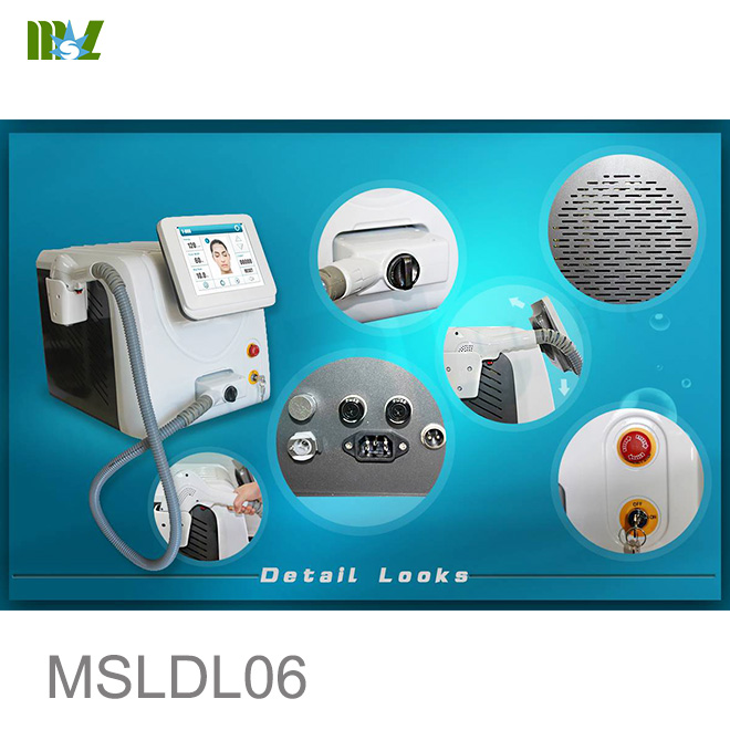 Cost of laser hair removal MSLDL06