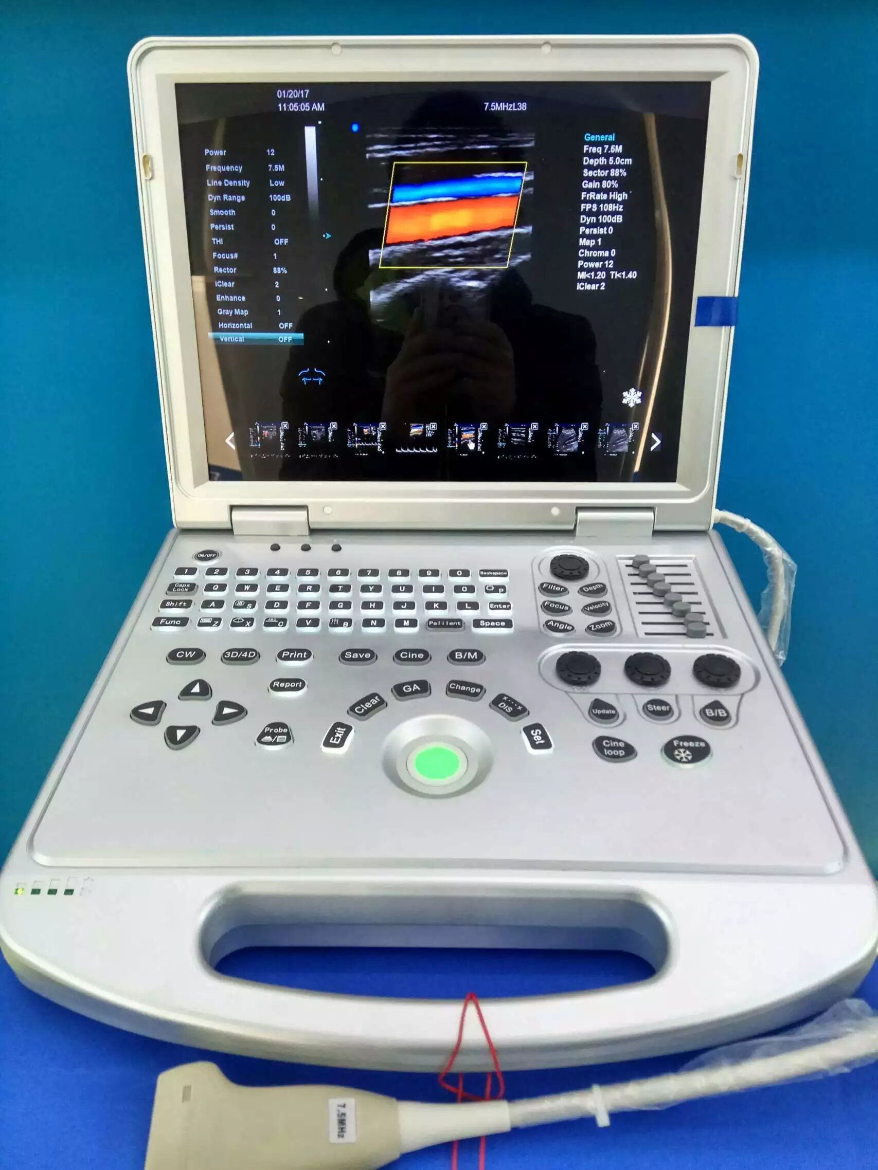 fetal color doppler ultrasound