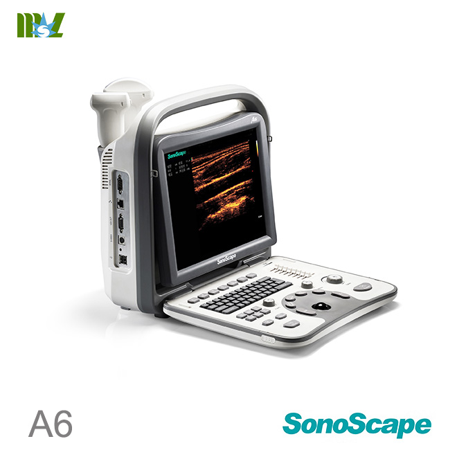 SonoScape A6