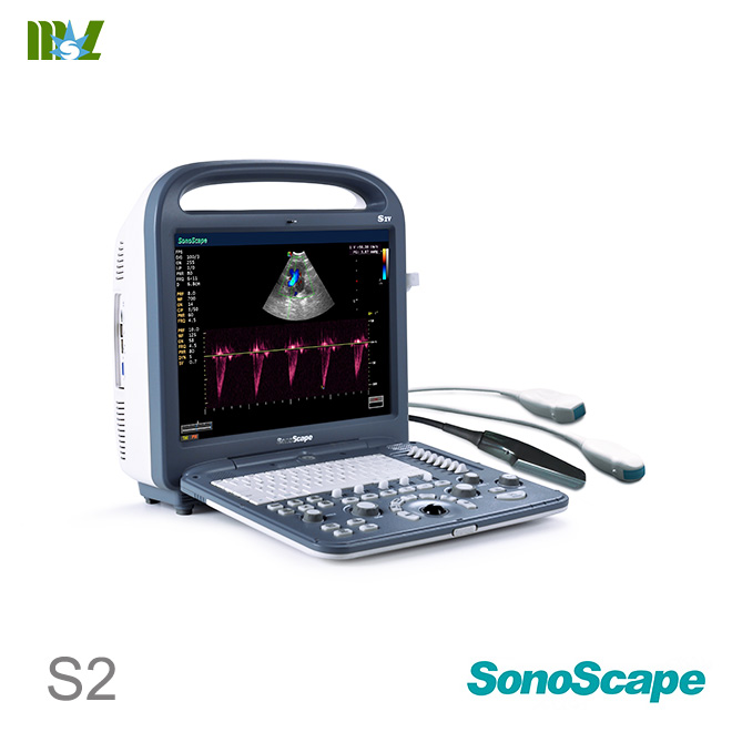 SonoScape S2