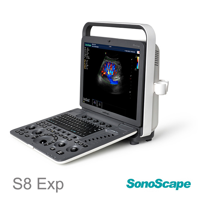 SonoScape S8EXP